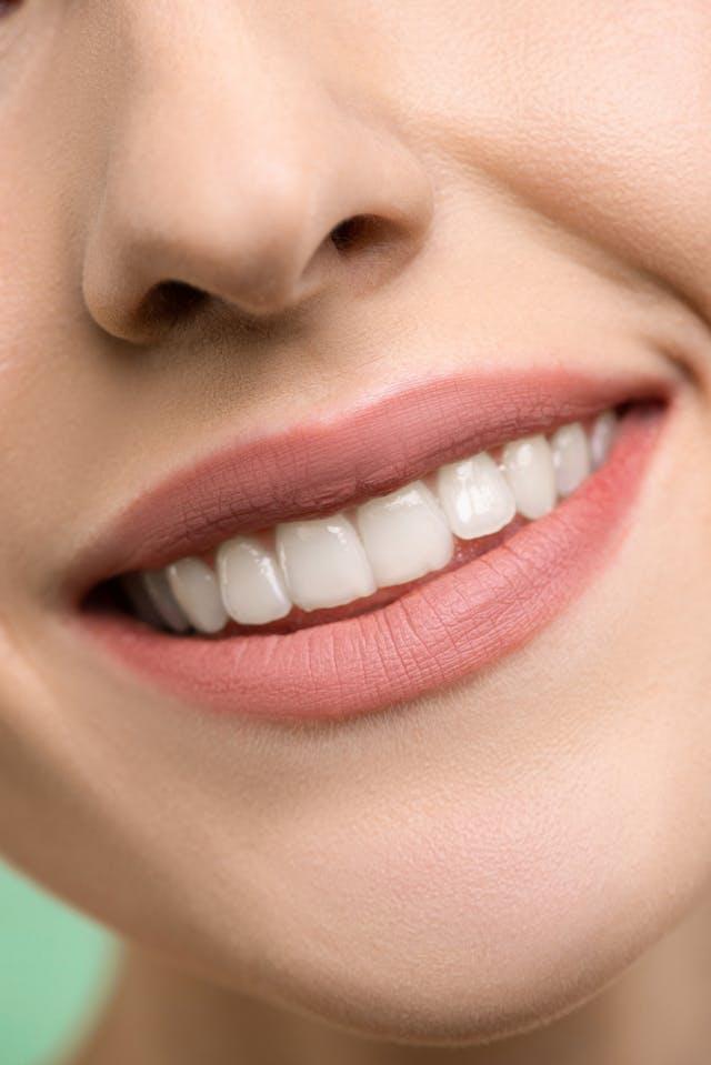 Bouche femme aux dents blanches