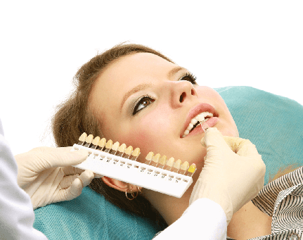 procédure pour placer les facettes dentaires