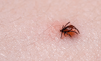 causes of lyme disease