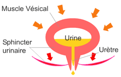 incontinence explanatory diagram