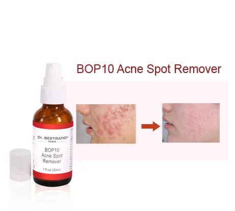 BOP10 Acne Spot Remover